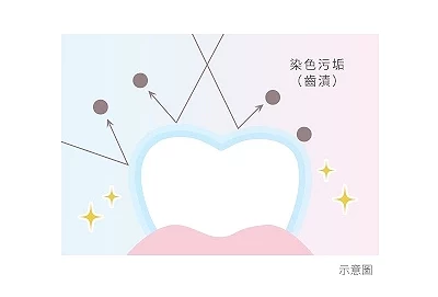 防色素附著配方示意圖